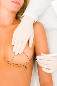 breast lift surgery