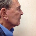 Facelift 03 After Thumbnail Photo