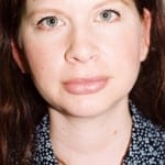 Chin Augmentation 01 After Thumbnail Photo