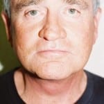 Facelift 16 After Thumbnail Photo