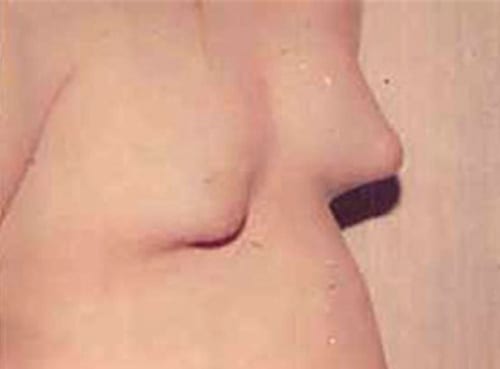 Male Cosmetic Surgery 07 Before Photo