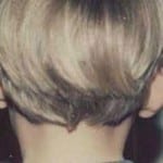 Otoplasty 01 Before Thumbnail Photo