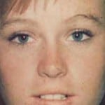 Otoplasty 02 Before Thumbnail Photo