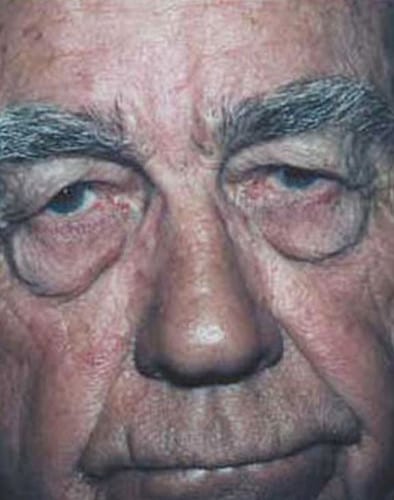 Male Cosmetic Surgery 03 Before Photo