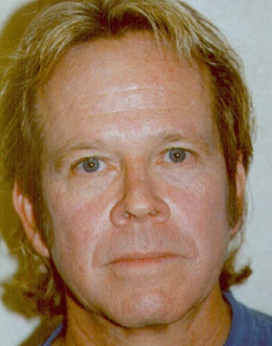 Male Cosmetic Surgery 04 Before Photo