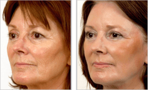 Screen Shot 2015-09-16 at 10.55.22 AM