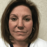 Rhinoplasty 06 After Thumbnail Photo